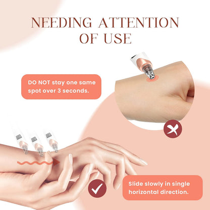 USB Rechargeable Blackhead Remover Vacuum – 5 Suction Levels, 5 Probes, Professional Facial Pore Cleaner and Acne Extractor (White)