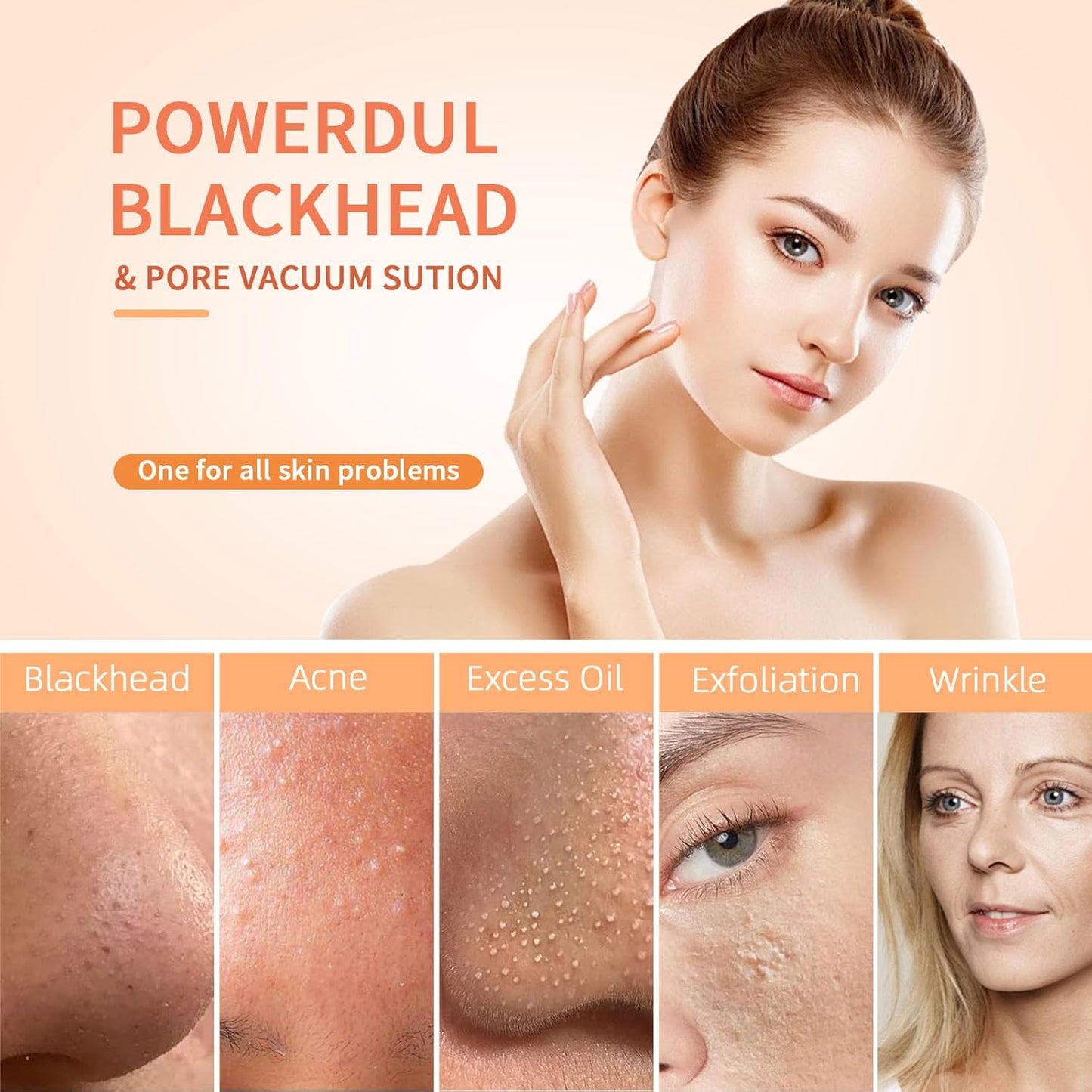 USB Rechargeable Blackhead Remover Vacuum – 5 Suction Levels, 5 Probes, Professional Facial Pore Cleaner and Acne Extractor (White)